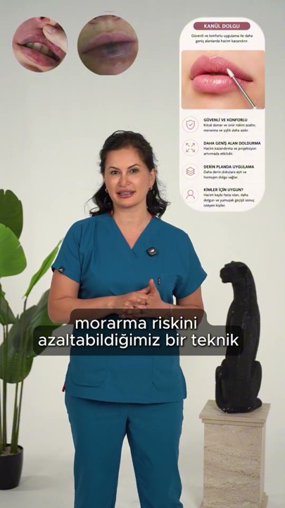 Dudak Dolgusunda En Çok Sorulan Soru